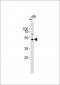 ASMT Antibody (Center)